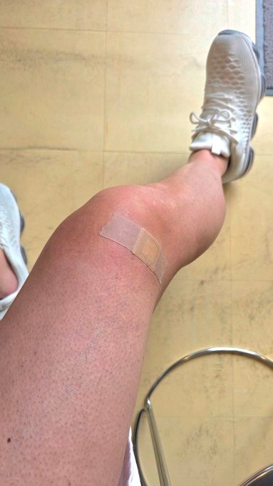 先日バスケットで膝を負傷！